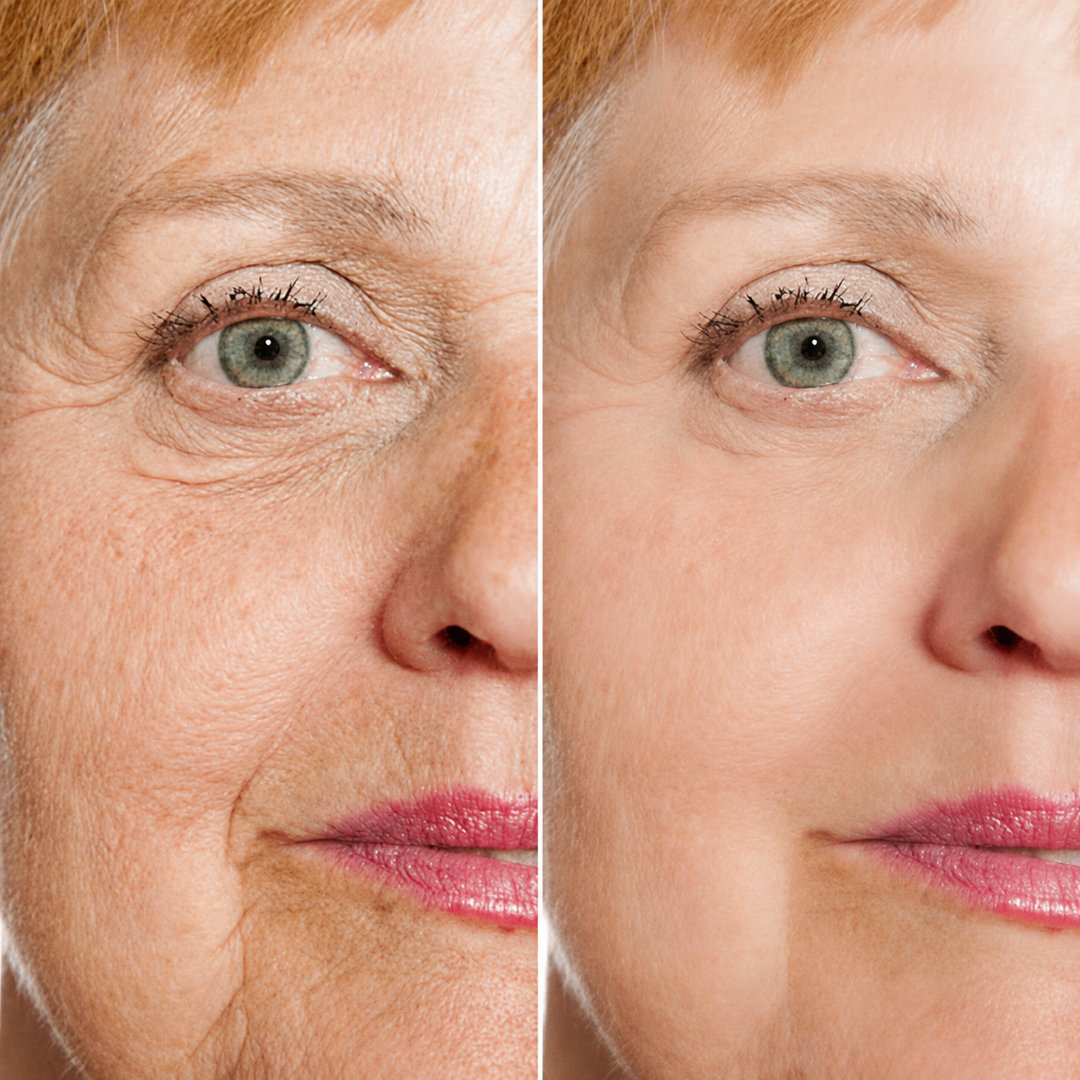 Hialura® - Serum Antiedad