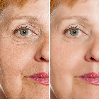 Hialura® - Serum Antiedad